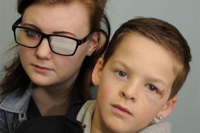 Kodie Cooper and her brother Kayne, who have both suffered eye injuries