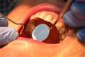 Dental patients will find ‘skeleton service’ as third of practices set to reopen