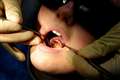 Dentists in England given further guidance on re-opening