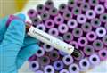 Coronavirus: What we know as a case is confirmed in Kent