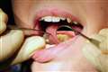 People forced to pull out their own teeth amid NHS dental crisis, report finds