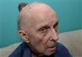 Man, 89, left with growing head wound nine months after fall