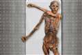 Iceman Otzi had dark skin and male pattern baldness, analysis reveals