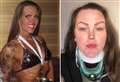 ‘I lost 16st and became a bodybuilder – now I can barely walk’