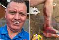 Kent school fitness coach suffers horror injury on holiday