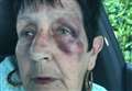 Hooded man punched grandmother in the face