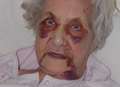 Woman, 89, savagely beaten by teen robber at home