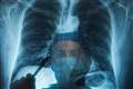 NHS campaign urges people not to ignore lung cancer symptoms