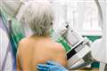 Cancer screening ‘must not get lost’ under other NHS pressures