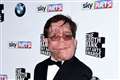 I got sick of being asked why I wasn’t wearing a mask, says actor Adam Pearson