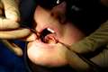 A quarter of adults have delayed dental treatment ‘because of the cost’