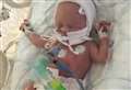 New hope for miracle baby