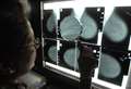 Hundreds of patients face cancer delays