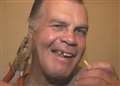 Tooth pain drives man to use pliers on own mouth