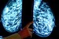 Breast cancer screening uptake below target for fourth consecutive year