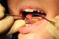 People turning to DIY dentistry as they struggle to access care – poll