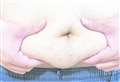 Obesity cases could overtake smoking 