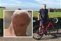 'He strangled me with my own bike helmet strap'