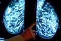 New drugs could target protein that fuels breast cancer