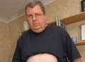 Major surgery to remove massive stomach lump