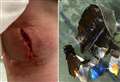 Mum slams council as boy, 9, suffers nasty gash on broken bottle