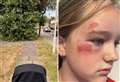 ‘They haven’t done their job – and now my kid’s face has been smashed up’