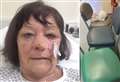 Gran bleeding from eye left waiting eight hours in A&E