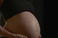 Stillbirths and premature births linked to poverty and race – study