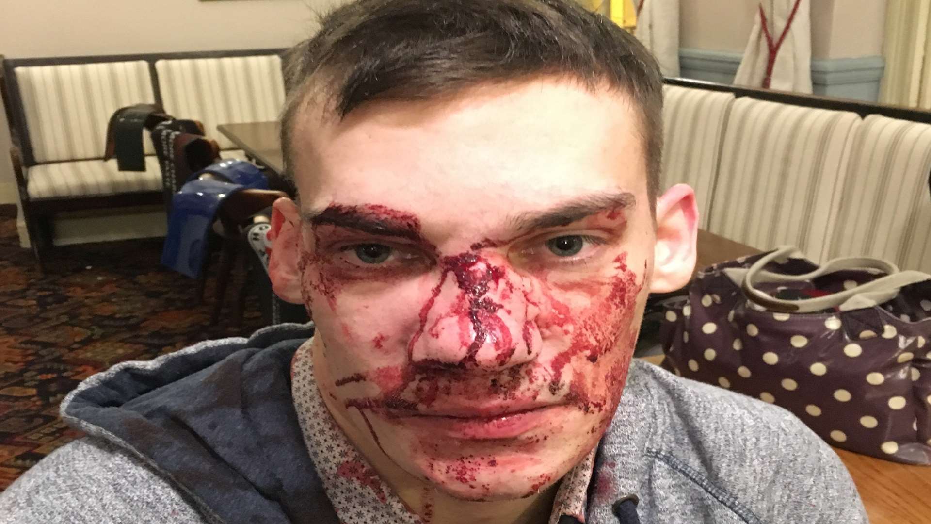 Matt Wilkins after being attacked