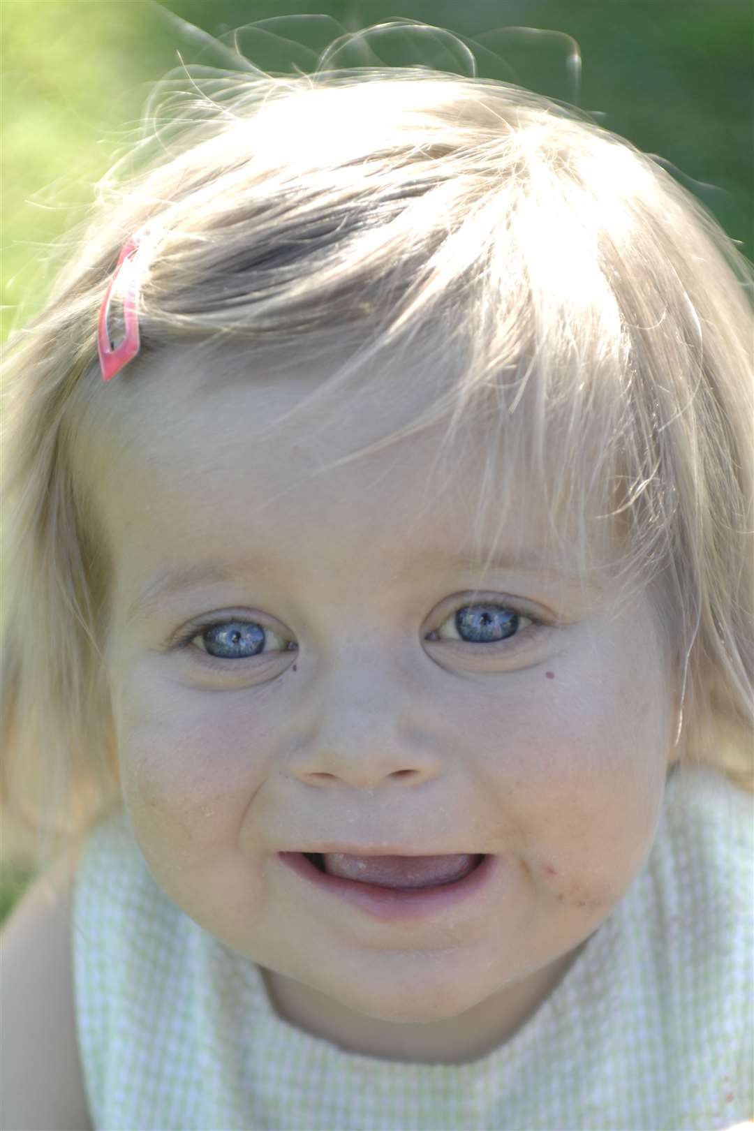 Lilly Beckett, who now lives in Margate, photographed before the operation at the age of one. Picture: Matthew Reading