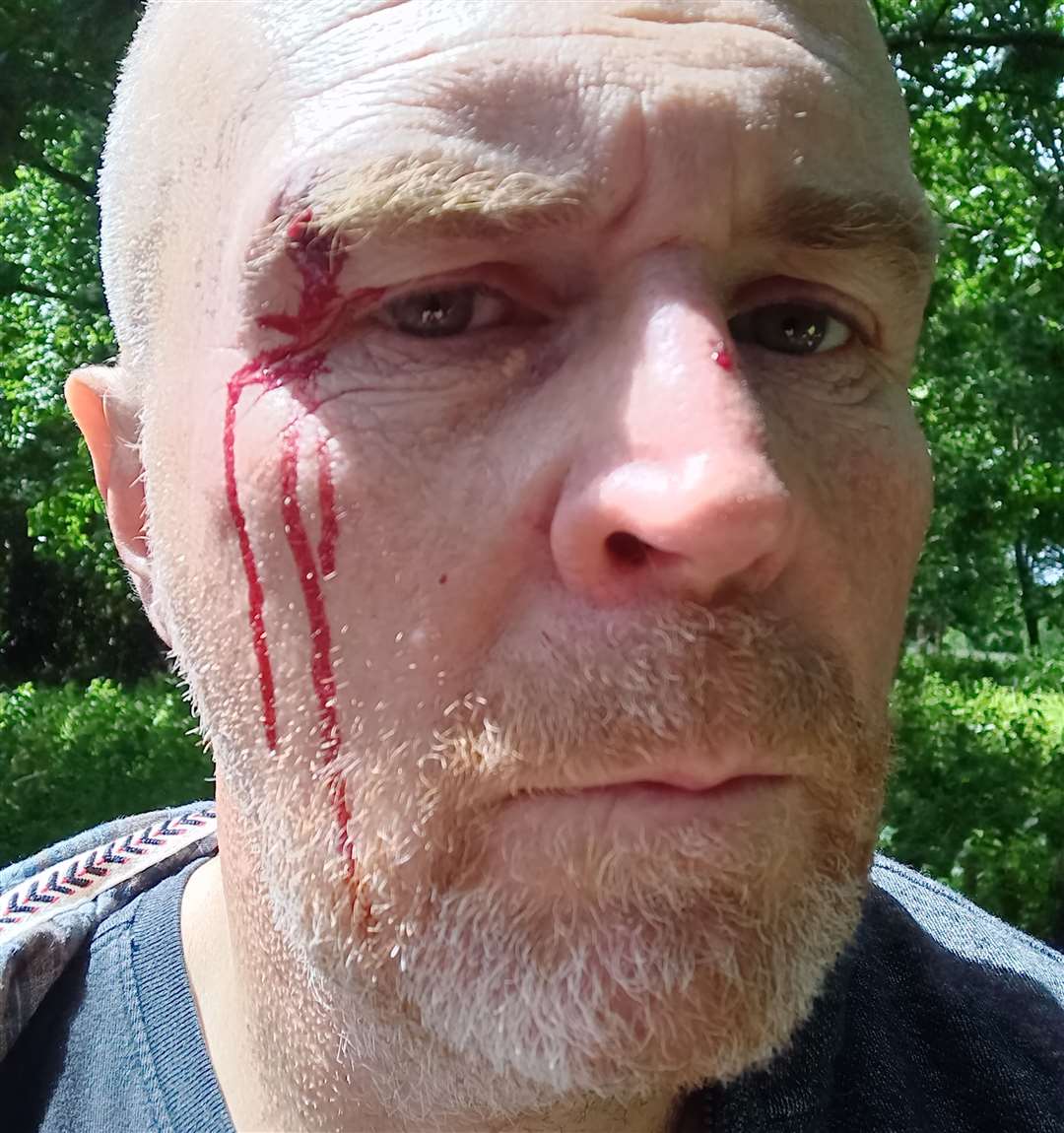 Brian Woodhouse was attacked in front of his two daughters in Ashford Road, Hollingbourne