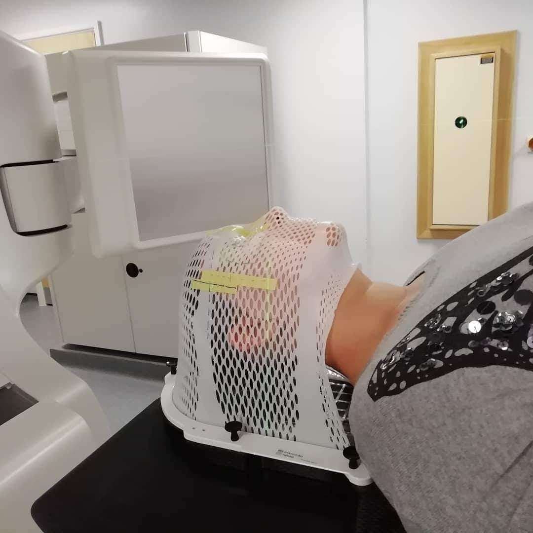 Toni Crews during radiotherapy at Kent and Canterbury Hospital