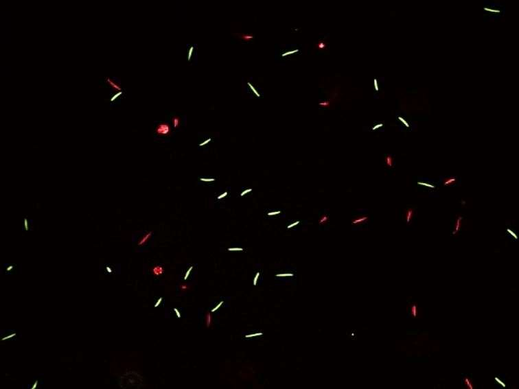 The red and green spots are live (green) and dead (red) sperm (University of Portsmouth/PA)