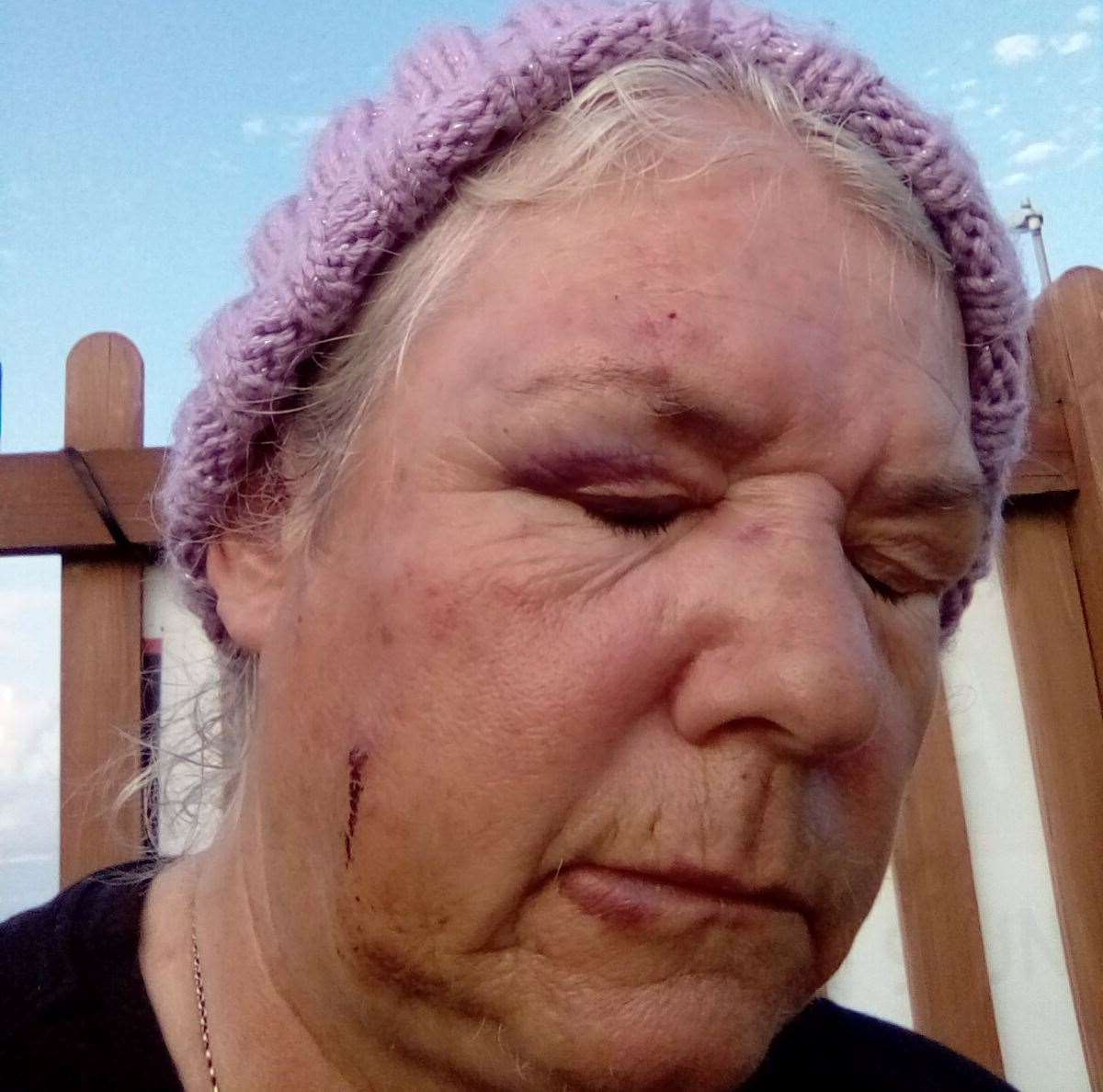 Ms Walker was attacked in Pencester Gardens on Saturday, July 20. Picture: Karen Walker