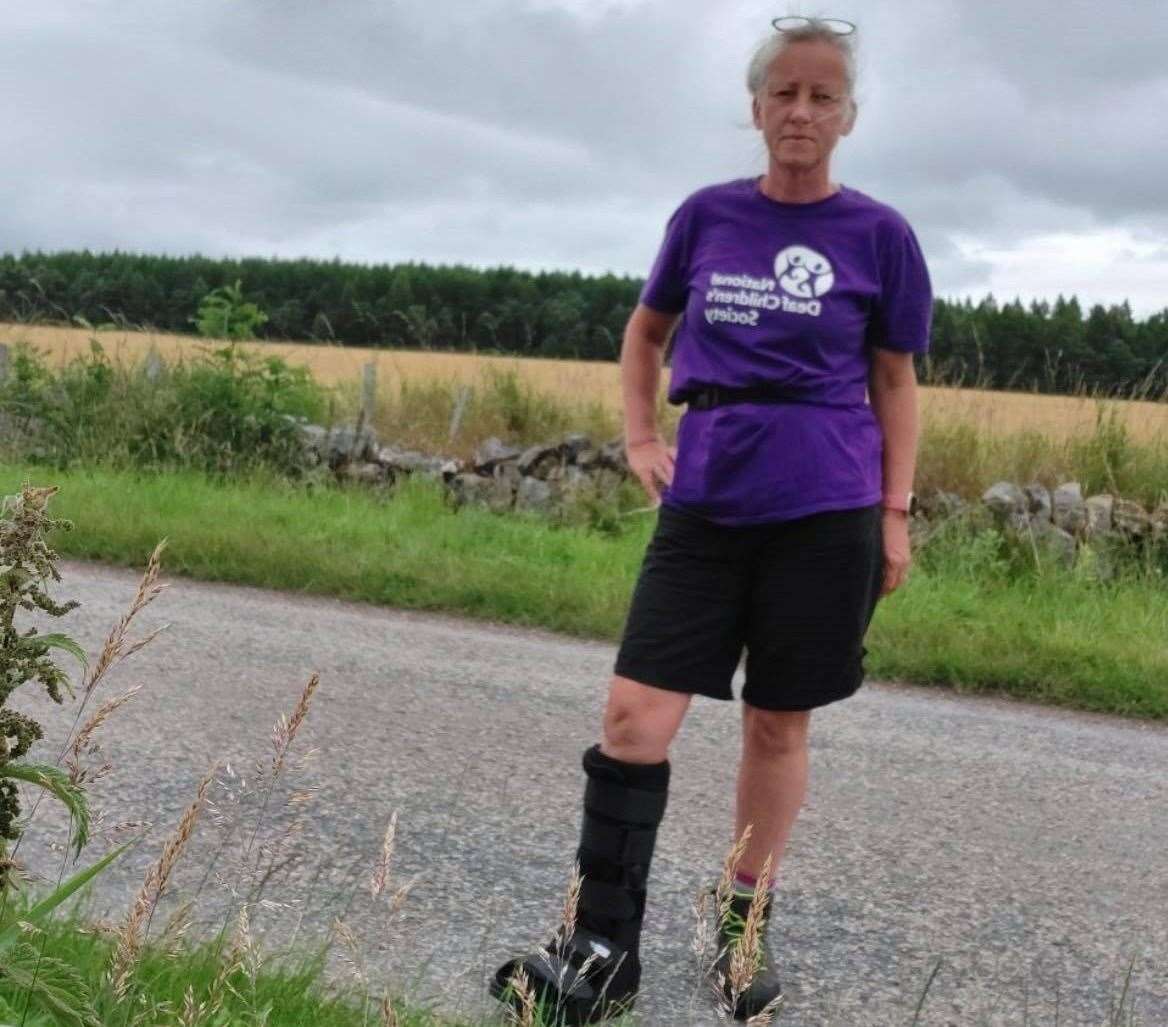 Natalie had to wear her medical boot for the last 100-miles after a leg infection from midge bites