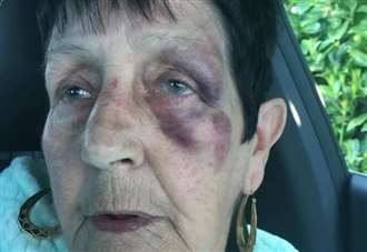 Hooded man punched grandmother in the face