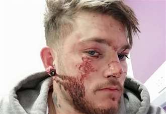 Man left bloodied and broken after late night attack