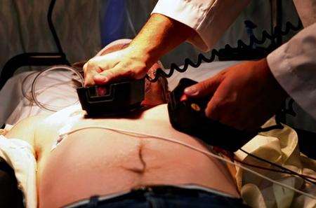 A heart attack patient being given CPR - picture posed by model