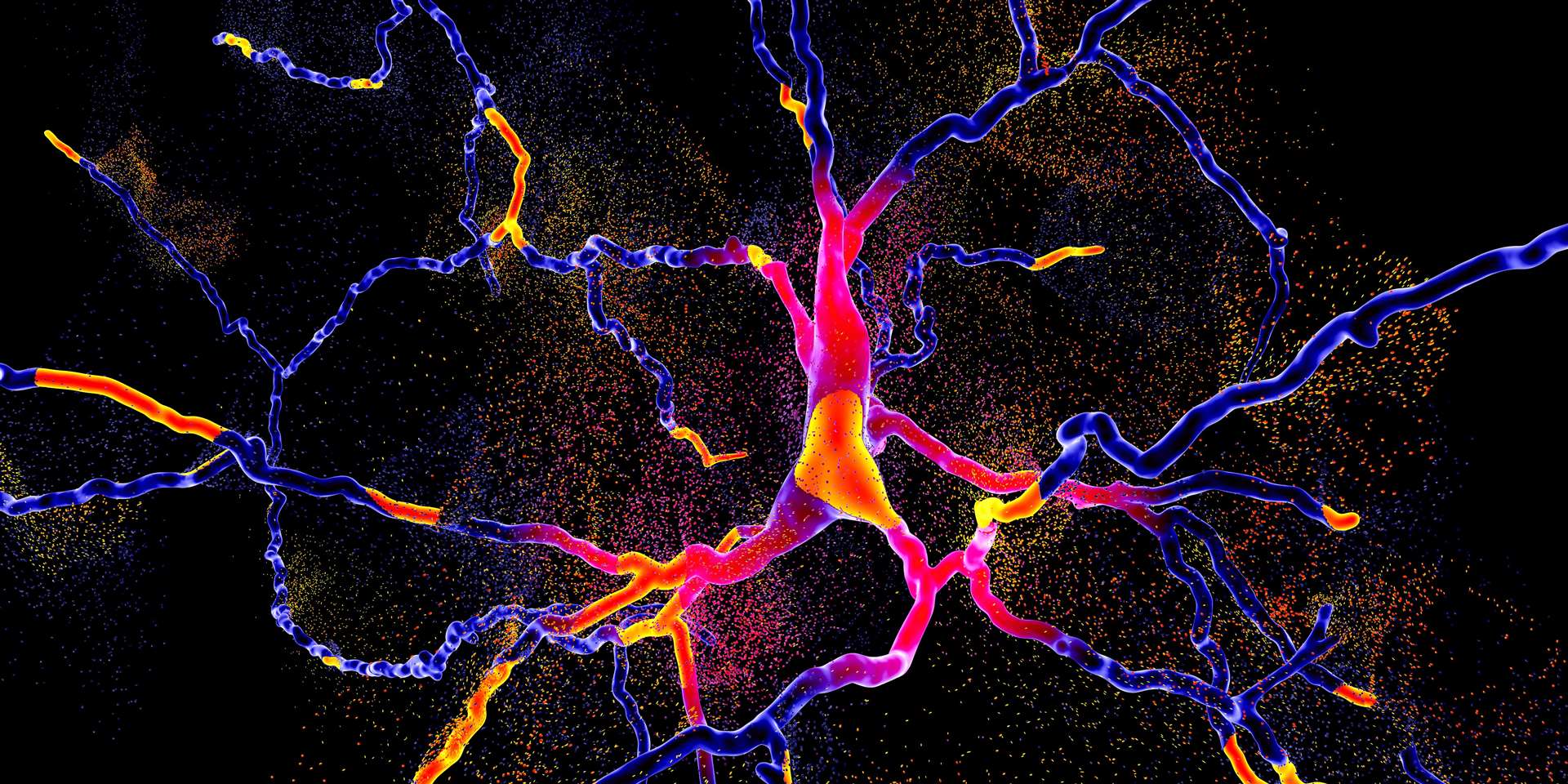 3D image showing degeneration of the dopaminergic neuron (University of Cambridge/PA)