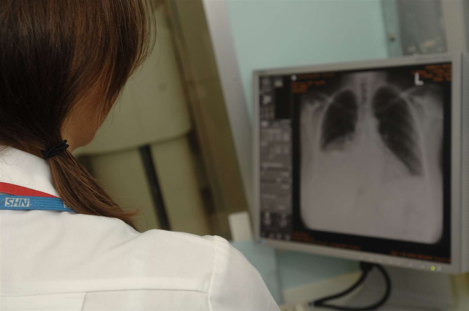 X-ray department. Stock photo