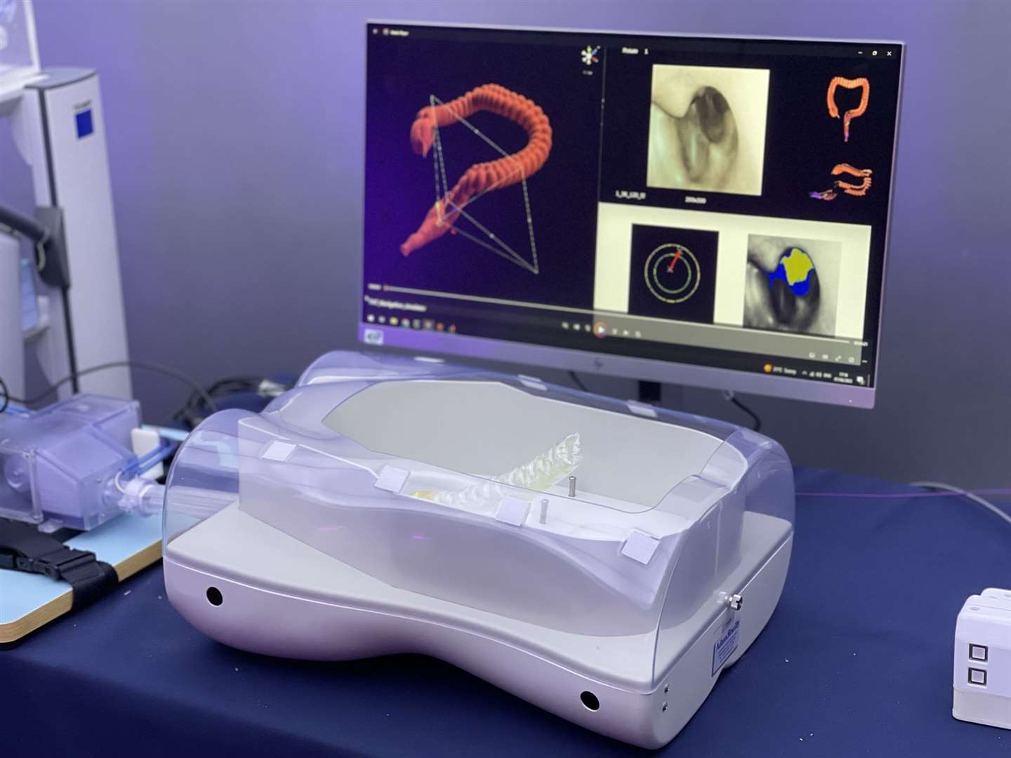 The robotic endoscope can self propel through the body (Ferdinando Rodriguez y Baena/Imperial College London)