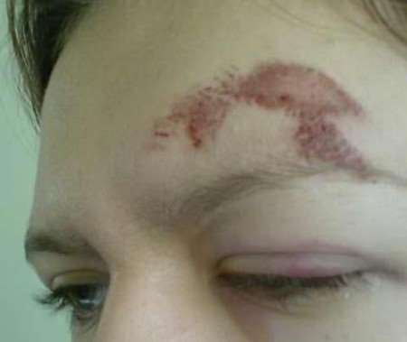 Lauren Heaver suffered severe cuts and bruising during the incident