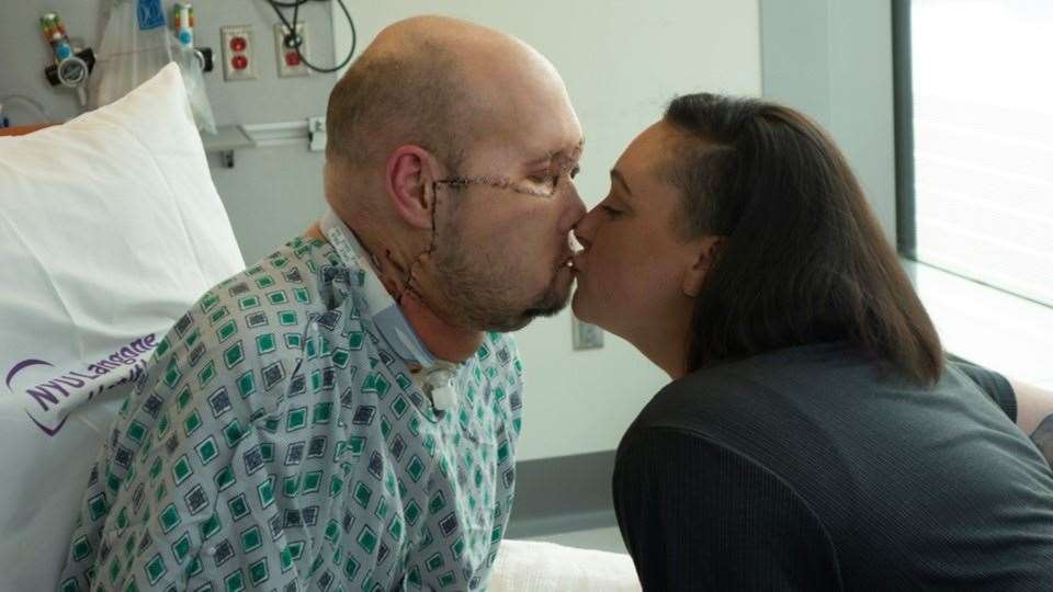 Aaron and wife Meagan kiss for first time since Aaron receives new face (NYU Langone Health)