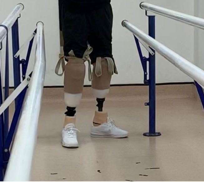 John Snow is learning to walk with his prosthetic legs. Picture: Karen Snow