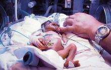 Twins Ruby and Daisy Black were born premature