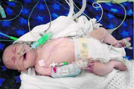 Hendrix Danger Mackay, who has been battling heart defects