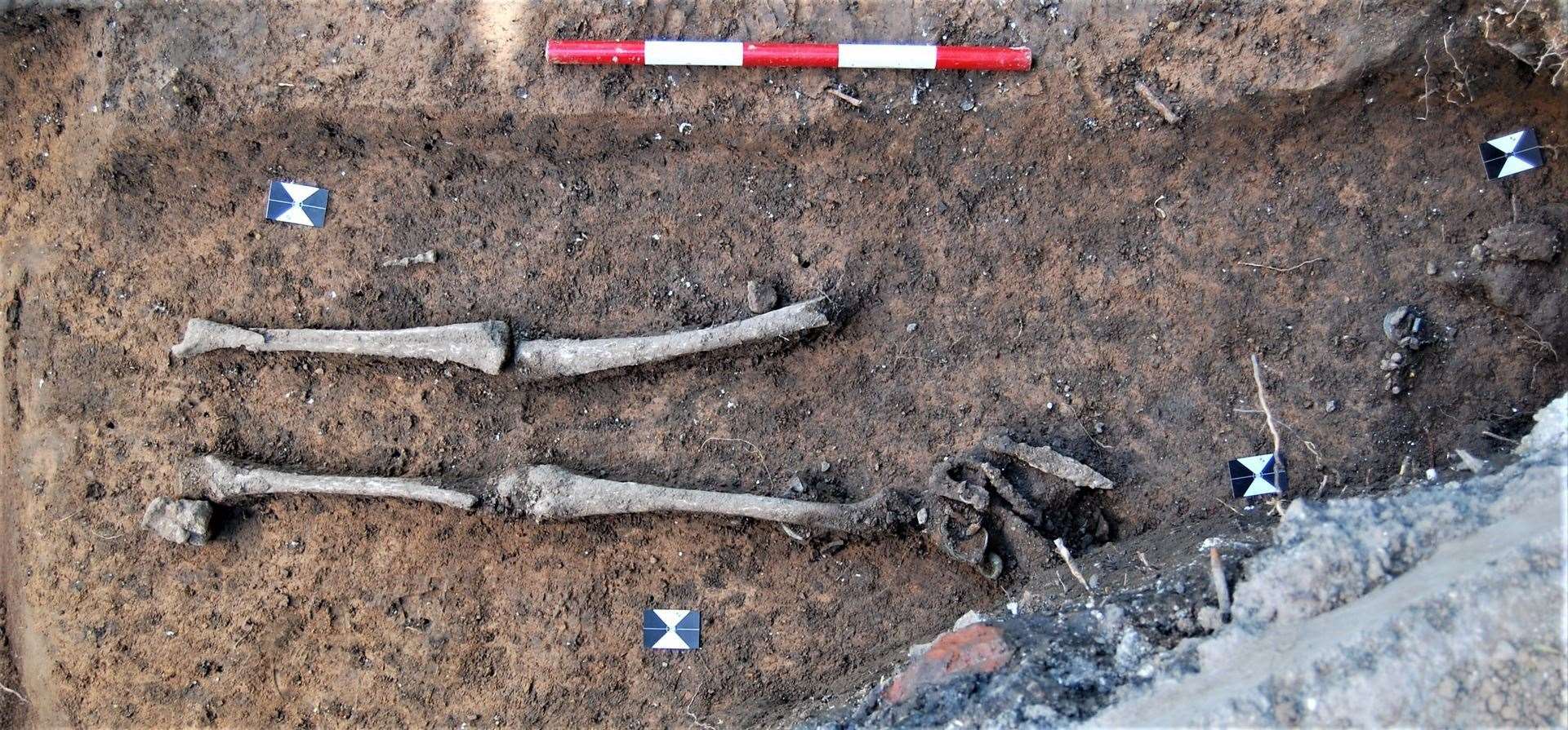 The skeleton of the Anglo Saxon woman (21999128)