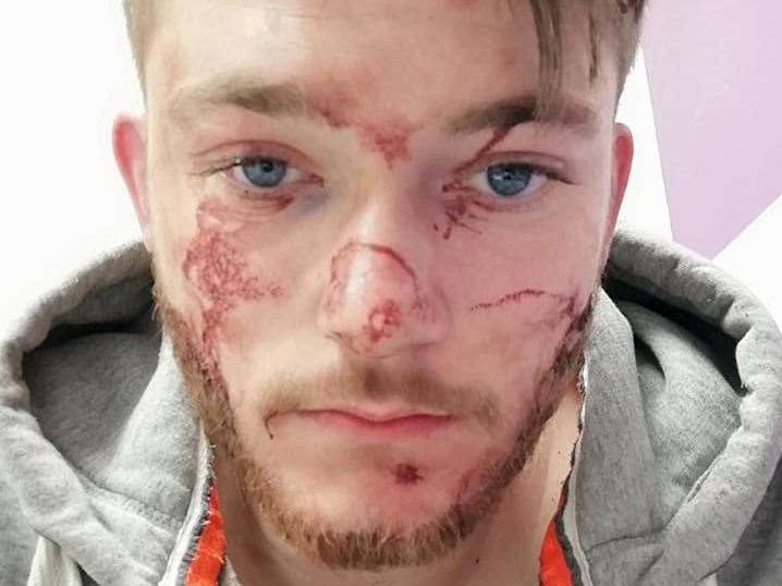 Luke Bingham was attacked overnight Tuesday