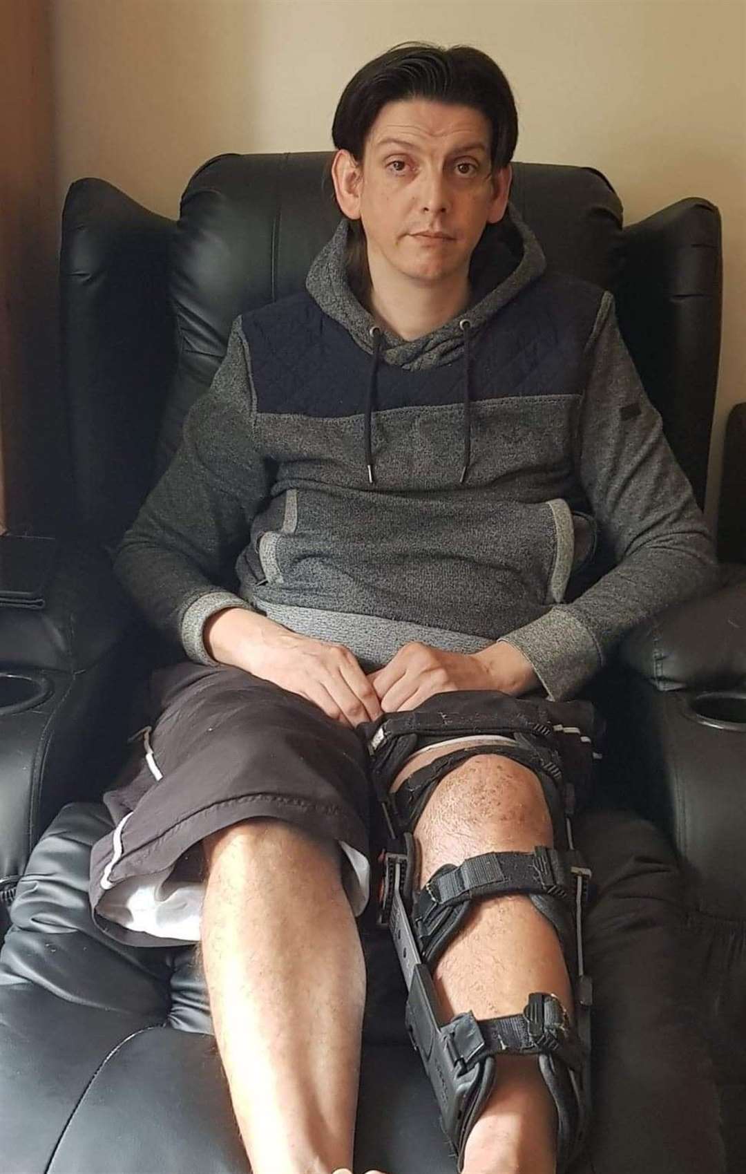 Daniel Boughton says he's been waiting 13 months for surgery to save his leg after a motorbike accident in August 2019