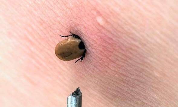 Ticks are parasites that burrow into their hosts to suck their blood. Picture: Google